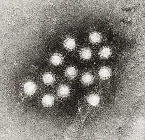 Electron micrograph of Hepatitis A virus