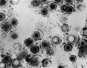Black-and-white electron micrograph of the herpes simplex virus.
