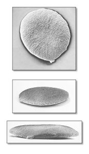 3 images of the bacterium that causes gonorrhea, which looks like gray disks