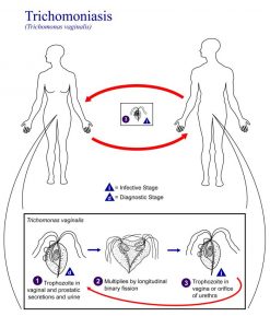 Life cycle of trichomoniasis