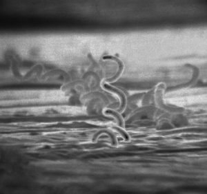 Grayscale micrograph of syphilis infection, which looks like curly yarn.