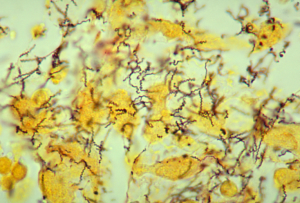 Close-up of the bacterium that causes syphilis, tinted yellow
